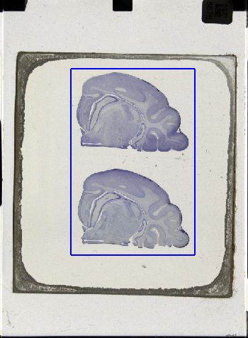 Media type: image; Special Collections 3043   shows specimen_part histological serial section;